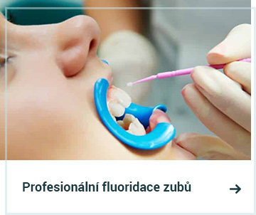 Profesionální fluoridace zubů